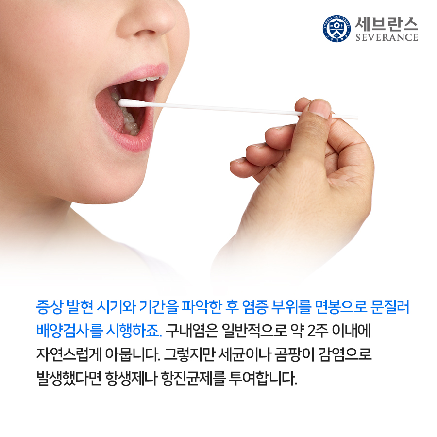 증상 발현 시기와 기간을 파악한 후 염증 부위를 면봉으로 문질러 배양검사를 시행하죠. 구내염은 일반적으로 약 2주 이내에 자연스럽게 아뭅니다. 그렇지만 세균이나 곰팡이 감염으로 발생했다면 항생제나 항진균제를 투여합니다. 