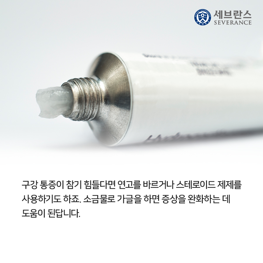 구강 통증이 참기 힘들다면 연고를 바르거나 스테로이드 제제를 사용하기도 하죠. 소금물로 가글을 하면 증상을 완화하는 데 도움이 된답니다.