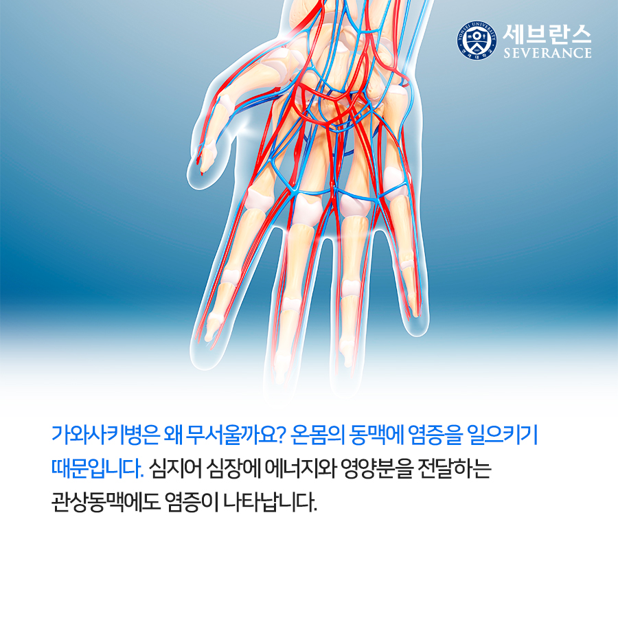 가와사키병은 왜 무서울까요? 온몸의 동맥에 염증을 일으키기 때문입니다. 심지어 심장에 에너지와 영양분을 전달하는 관상동맥에도 염증이 나타납니다. 