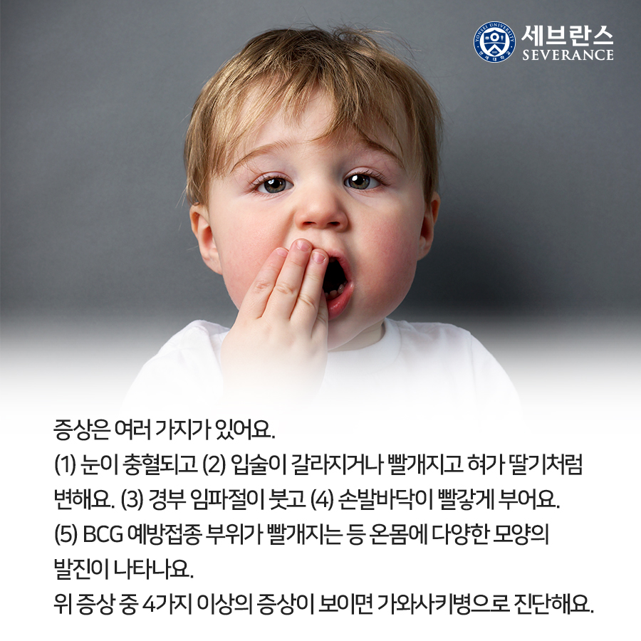 증상은 여러 가지가 있어요. (1) 눈이 충혈되고 (2) 입술이 갈라지거나 빨개지고 혀가 딸기처럼 변해요. (3) 경부 임파절이 붓고 (4) 손발바닥이 빨갛게 부어요. (5) BCG 예방접종 부위가 빨개지는 등 온몸에 다양한 모양의 발진이 나타나요. 위 증상 중 4가지 이상의 증상이 보이면 가와사키병으로 진단해요.