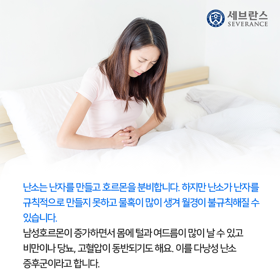 난소는 난자를 만들고 호르몬을 분비합니다. 하지만 난소가 난자를 규칙적으로 만들지 못하고 물혹이 많이 생겨 월경이 불규칙해질 수 있습니다. 남성호르몬이 증가하면서 몸에 털과 여드름이 많이 날 수 있고 비만이나 당뇨, 고혈압이 동반되기도 해요. 이를 다낭성 난소 증후군이라고 합니다.