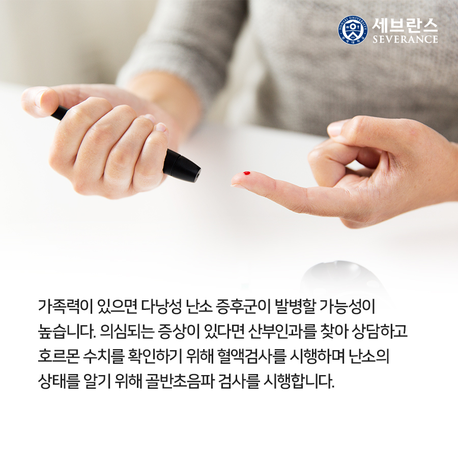 가족력이 있으면 다낭성 난소 증후군이 발병할 가능성이 높습니다. 의심되는 증상이 있다면 산부인과를 찾아 상담하고 호르몬 수치를 확인하기 위해 혈액검사를 시행하며 난소의 상태를 알기 위해 골반초음파 검사를 시행합니다.